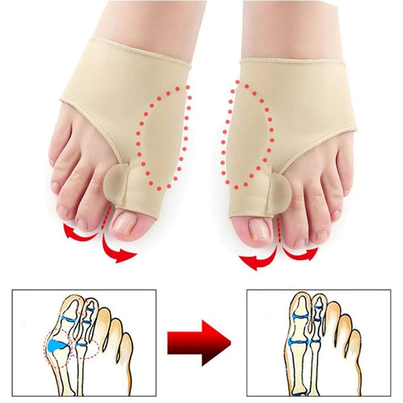 Joanete FreePad – Alívio e Correção com Conforto